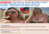 Anonymous (ID: 7uKOBc0r) 07/23/26(Thu)17:41:06 No.539494305 EXCLUSIVE I've had so much lip filler I have trouble breathing and can't close my mouth... but I have no plans to stop 190 KB JPG >>539493931 Not this time Greece. This time you freeze. I'd catch a boat to Africa. Get as far south as you can. Anonymous (ID: whVWf/yl) >>539494305 >gimmie that baboon ass look 07/23/26(Thu)17:46:19 No.539494561
