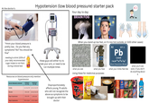 At the doctor's Hypotension (low blood pressure) starter pack Your day to day: BRAIN FOG "Hmm your blood pressure is pretty low... Do you feel any symptoms? No? You should be fine" needing to drink 120% of your daily recommended sugar intake to not faint during a blood test these guys will either try to break your arm, or need to be run multiple times Resources on blood pressure only mention hypertension BLOOD PRESSURE CATEGORY SYSTOLIC (mm Hg) DIASTOLIC (mm Hg) When you stand up too fast, or it's too hot outside, or [100 other cases]: 207.2 what you see what you hear Using these for medicinal purposes: Lay's Healthy Elevated Less than 120 and less than 80 120 to 129 and less than 80 Stage 1 hypertension 130 to 139 or 80 to 89 Stage 2 hypertension 140 or higher or 90 or higher Disproportionately affects young, fit adults who will not recognize the above as symptoms to be brought up with their doctor 辛 WOLES WITH SOUP M 라모 SHIN RAMYU POUR SOUR CLASSIC REAL POTATOES 82 Pb Lead [Xe]4f145d6s6p? Post-Transition Metal what your limbs feel like what you'll see soon, if you don't do anything about it Coca-Cola Coca-Cola