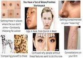 You Have a Ton of Moles/Freckles Starterpack Getting these in places where the sun don't shine + Constantly checking for cancer Ugly in Asia, Cute Quirck in West FRECKLES Getting Complimented on your "nose ring" AFTER BEFORE Comparing youself to these Confused why people without these features want to do this now Constellations on your Arm