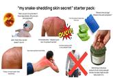"my snake-shedding skin secret” starter pack: "Wait, you put on sunscreen 2 hours ago already. Why are you still lying here?" "Cut me a piece of aloe vera. Hurry up." "Where's the ice bag? Where's the cold compress?" OUCH! nahh, that's fine, my skin doesn't burrnn 15 minutes later: "nobody touch me. I'm sunburnt as hell." "Finally, it's time to peel" shhh. shhhhhhhh face-down position at all times no more working outfit in this URGENT CASE UGHTER Slathering a ridiculous amount of non-sticky aloe gel all over my body might as well take a bath in it.