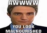 AWWWW YOU LOOK MALNOURISHED