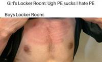 Girl's Locker Room: Ugh PE sucks I hate PE Boys Locker Room: Skin Shoulder Joint Arm Scar