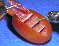 yoo they did surgery on a grape