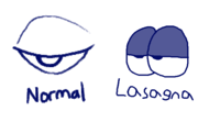Normal Eye vs. Lasagna