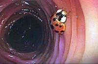 Miraculous, simply the best...