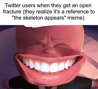 Twitter users when they get an open fracture (they realize it's a reference to "the skeleton appears" meme)