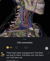 325 168 comments (2 That's bad cable management. Pull them out and fix them. Pull them out. Pull them out. Pull them out Darth45789 8h