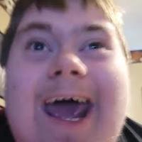 Jamesdroz566 "What Happeneduhh?" Reaction Image