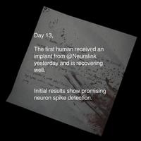 Day 13, The first human received an implant from @Neuralink yesterday and is recovering well. Initial results show promising neuron spike detection.