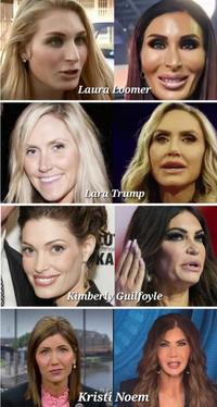 the question is yes they are all trump fans and are all ugly because of surgery