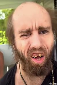 The Lolcow known as Cyraxx the Goblin