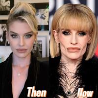 Then Now
