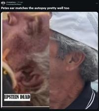 r/conspiracy. 13h ago EverybodyGetsWasps Petes ear matches the autopsy pretty well too EPSTEIN DEAD