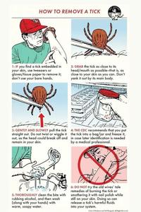 HOW TO REMOVE A TICK ACTION 1: IF you find a tick embedded in your skin, use tweezers or gloves/tissue paper to remove it; don't use your bare hands. 2: GRAB the tick as close to its head/mouth as possible-that is, as close to your skin as you can. Don't yank it out by its main body. 3: GENTLY AND SLOWLY pull the tick straight out. Do not twist or wiggle it out, as the head could break off and remain in your skin. 4: THE CDC recommends that you put the tick into a bag/jar and freeze it, in case later identification is needed by a medical professional. 5: THOROUGHLY clean the bite with rubbing alcohol, and then wash (along with your hands) with warm, soapy water. 6: DO NOT try the old wives' tale remedies of burning the tick or smothering it with nail polish while still on your skin. Doing so can release a tick's harmful fluids into your system. Arif Manline and Ted Slampyak. All Rights Reserved.