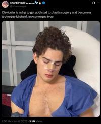 sharon vape a @sharonvape Clavicular is going to get addicted to plastic surgery and become a grotesque Michael Jacksonesque type 7:50 PM - Jun 4, 2026 3.5M Views Ø ...