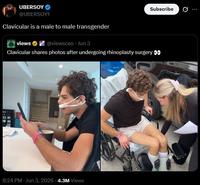 UBERSOY @UBERSOY1 Clavicular is a male to male transgender views @viewsceo - Jun 3 Subscribe Ø.. Clavicular shares photos after undergoing rhinoplasty surgery 8:24 PM - Jun 3, 2026 -4.3M Views