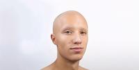 Kwebbelkop Hairless