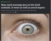 TENDER-EYE-ZED Man used massage gun on his tired eyeballs. It went as well as you'd expect. He had retinal tears and bruises from squishing his eyeballs with the gun. BETH MOLE - JUN 22, 2026 6:02 PM 165