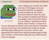 Anonymous 185 KB PNG 07/25/26(Sat) 18:09:34 No.951880152 I was clipping my toenails last night and one of the bigger ones just launched itself like a goddamn missile straight up my urethra, bounced around in there for a bit, then somehow lodged itself deep in my bladder next to what the doctor is now calling a "toenail-encrusted kidney stone cluster," so they have to go in through my rectum with some kind of industrial vacuum hose and a tiny jackhammer while i'm awake and they keep telling me to "try not to clench," and apparently the toenail has started growing again inside me so there's a real chance they pull out a fully formed foot, you big gay