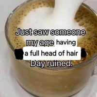 Just saw someone my age having a full head of hair Day ruined.