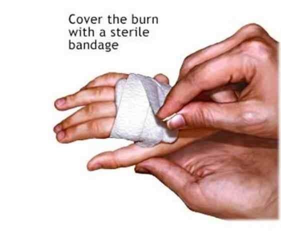 Cover the burn with a sterile bandage