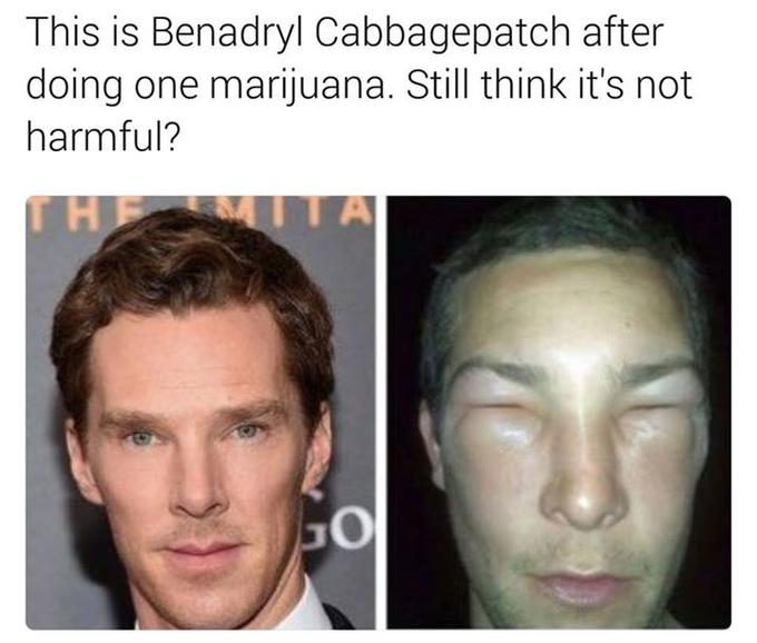 This is Benadryl Cabbagepatch after doing one marijuana. Still think it's not harmful? 10