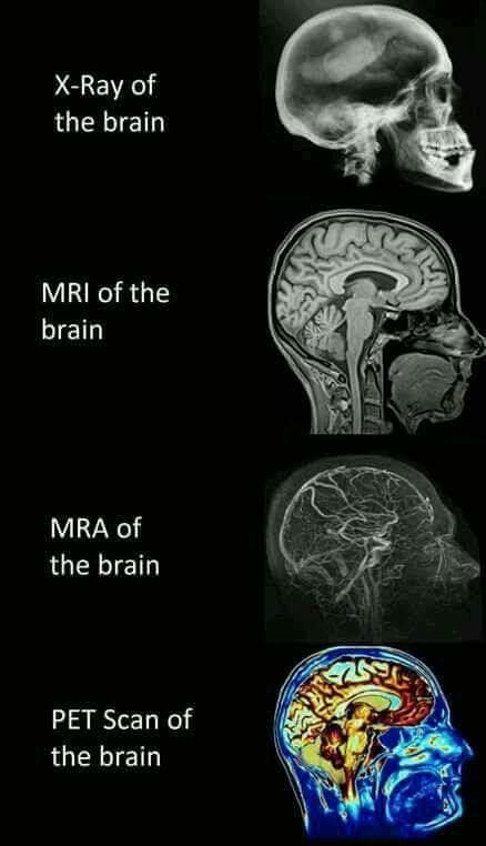 X-Ray of the brain MRI of the brain MRA of the brain PET Scan of the brain