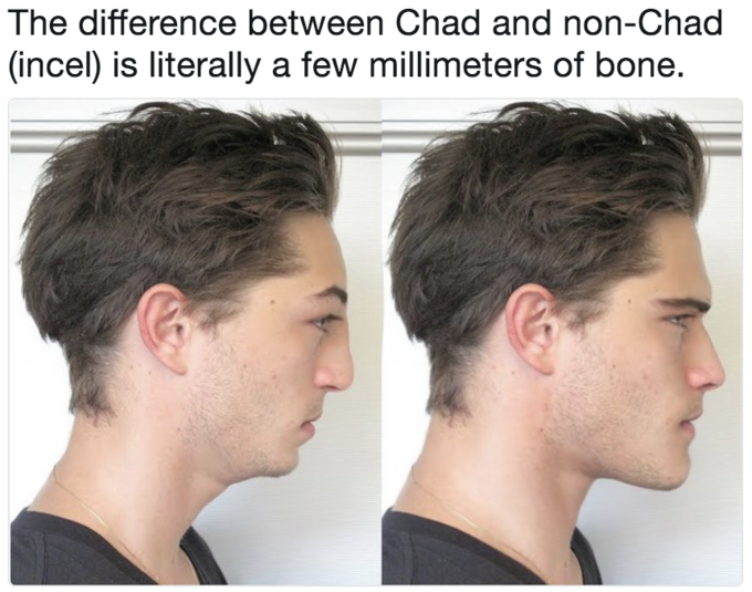 The difference between Chad and non-Chad (incel) is literally a few millimeters of bone. The difference between Chad and non-Chad (incel) is literally a few millimeters of bone.