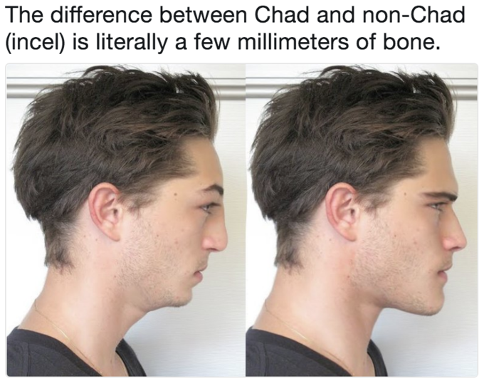 The difference between Chad and non-Chad (incel) is literally a few millimeters of bone.