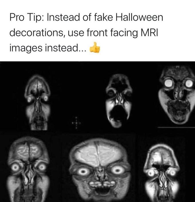 Pro Tip: Instead of fake Halloween decorations, use front facing MRI images instead...