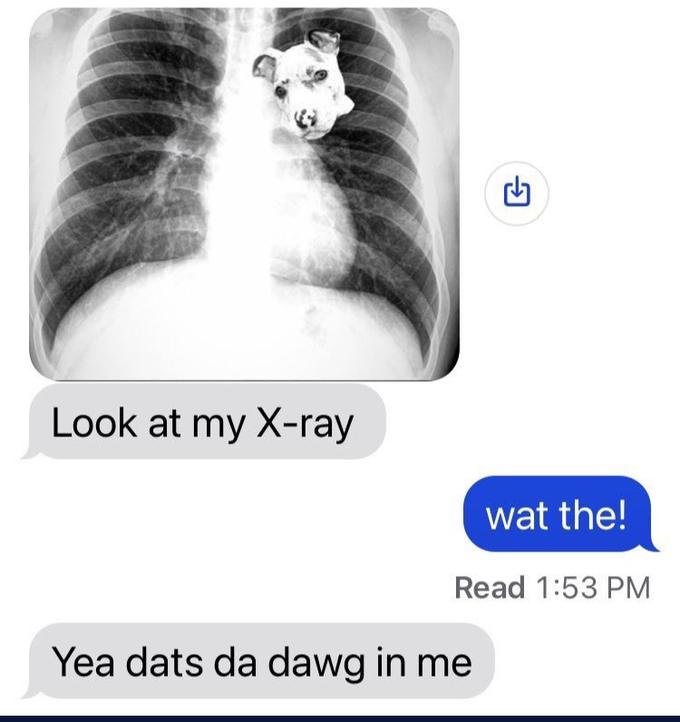 Look at my X-ray wat the! Read 1:53 PM Yea dats da dawg in me