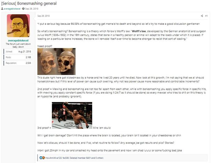 [Serious] Bonesmashing general averageblokecel ● Sep 26, 2018 averageblokecel The forum just went down baby, down Aug 21, 2018 Joined: Posts: Reputation: 2,166 2.538 Sep 26, 2018 < #1 *I put a serious tag because 98.58% of bonesmashing get meme'd to death and beyond so let's try to make a good discussion gentlemen So what's bonesmashing? Bonesmashing is a theory which follow's Wolff's law: "Wolff's law, developed by the German anatomist and surgeon Julius Wolff (1836-1902) in the 19th century, states that bone in a healthy person or animal will adapt to the loads under which it is placed. If loading on a particular bone increases, the bone will remodel itself over time to become stronger to resist that sort of loading." Need proof? This dude right here got kickedmaxx by a horse and he lived 20 years until he died. Now look at this growth, I'm not saying that we all should horsekickmaxx but if this level of power can cause such swelling, why not less power cause more reasonable and controllable increments? 2nd proof = Mewing and bonesmahing are not too fall apart from each other, while with bonesmashing you apply specific force in specific hits, with mewing you apply constant specific force (if you are doing it 24/7 as it should be done) so every mewcel who tries to s--- on this theory is an hypocrite (and probably ignorant). 3rd proof= Mire 'em skullz Will I get brain damage? Don't hit the place where the brain is located, your brain isn't located in your cheekbones or chin Now let's discuss, should it be done, and if so, what routine to follow? Any average joe got results and pics? Stories? Inb4 I got 25mph in my car and smashed my head onto the pavement and now I am chad lululul or some f------ bad joke HowAmlAlive123, far336. Deleted member 6401 and 5 others