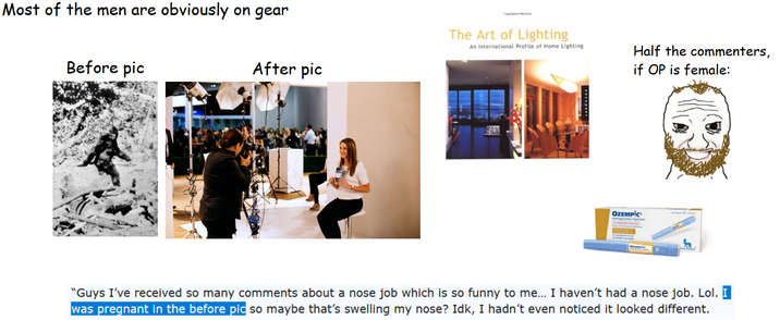 Most of the men are obviously on gear Before pic After pic Copyrighted Material The Art of Lighting An International Profile of Home Lighting Half the commenters, if OP is female: OZEMPIC injection "Guys I've received so many comments about a nose job which is so funny to me... I haven't had a nose job. Lol. was pregnant in the before pic so maybe that's swelling my nose? Idk, I hadn't even noticed it looked different.
