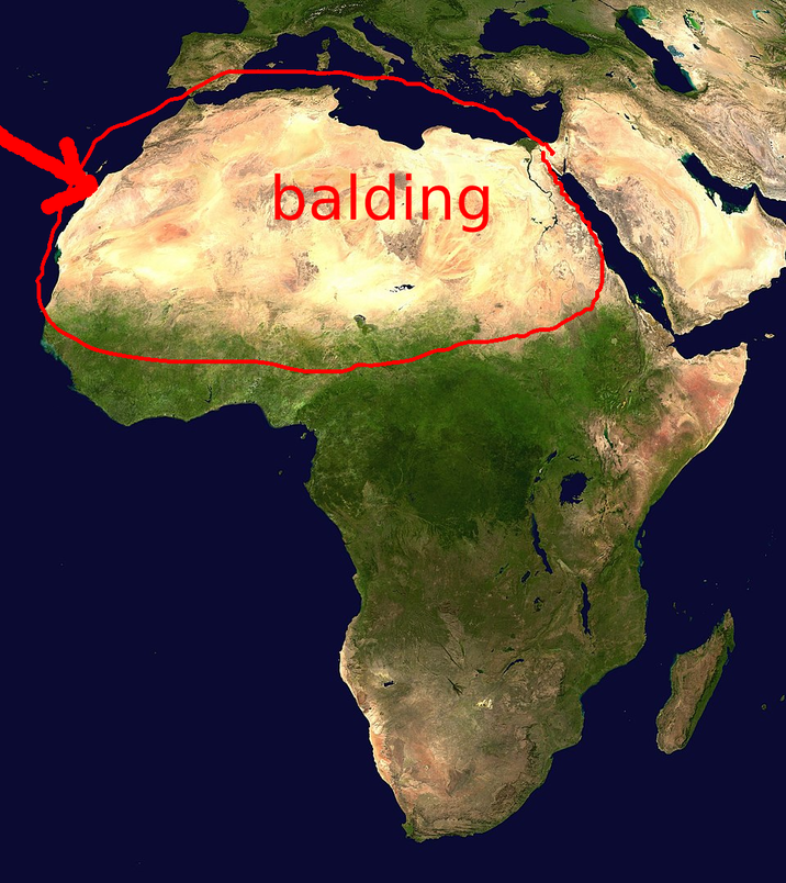 balding