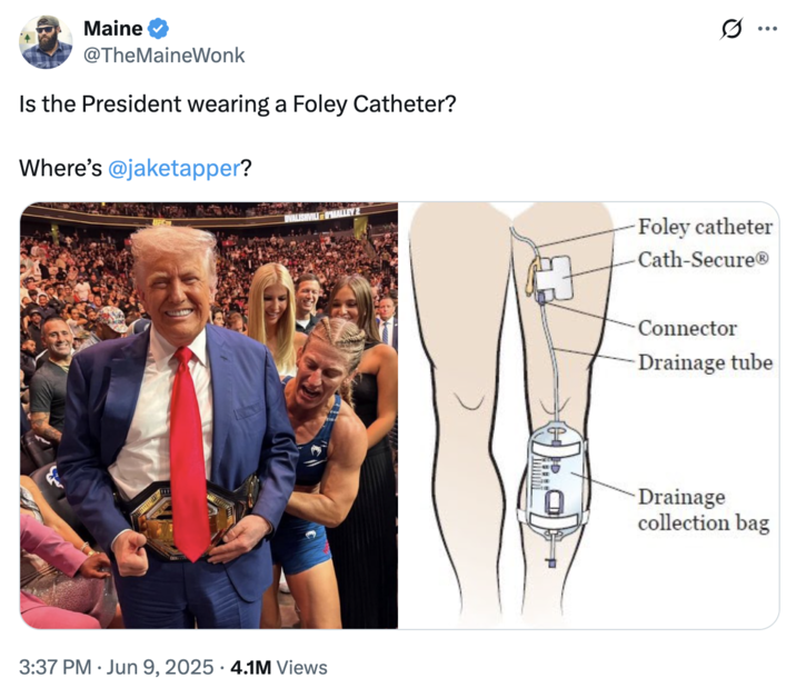 Maine @TheMaineWonk Is the President wearing a Foley Catheter? Where's @jaketapper? Ø ... 3:37 PM Jun 9, 2025 4.1M Views Foley catheter Cath-Secure® Connector Drainage tube Drainage collection bag