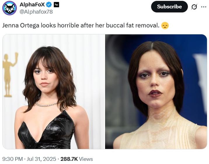 A tweet reading, "Jenna Ortega looks horrible after her buccal fat removal. 😞" The tweet shares images of Jenna Ortega.