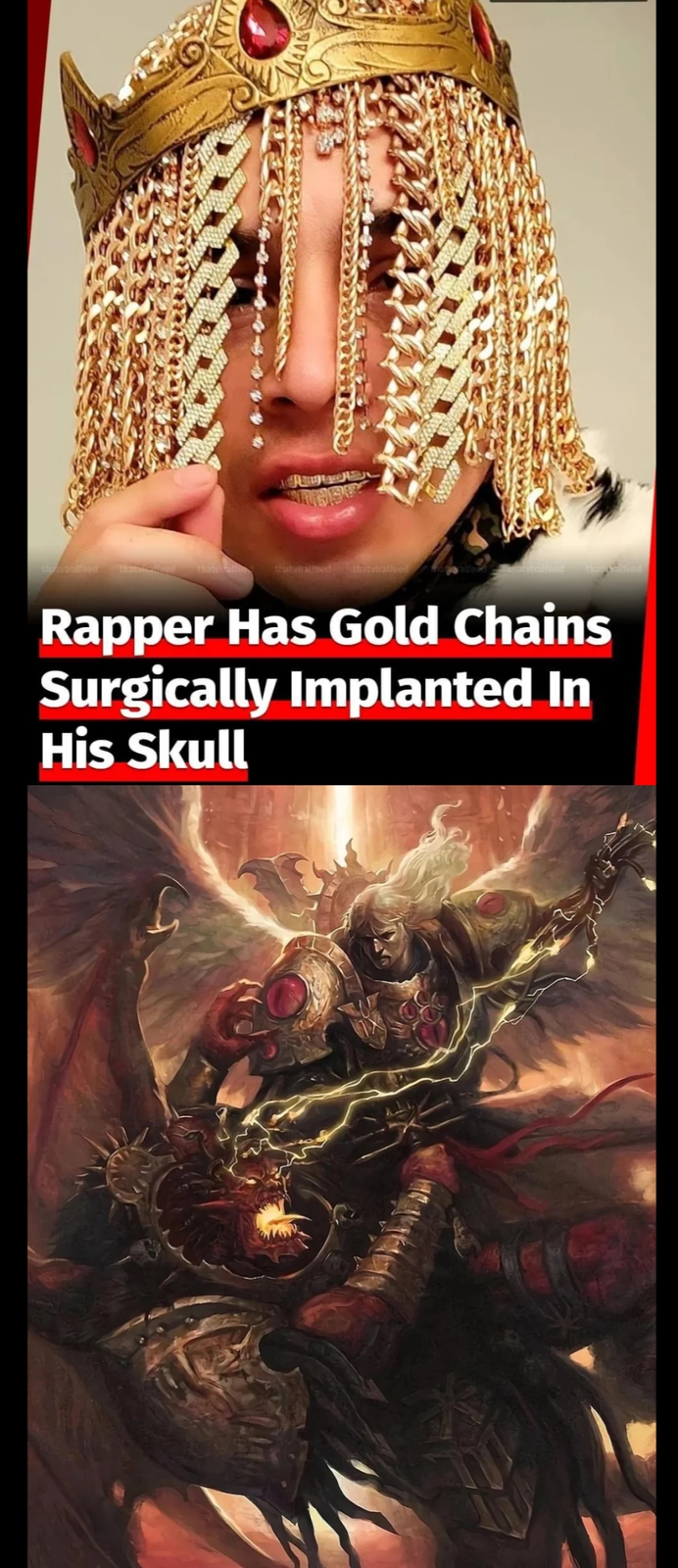 thetratfeed thatviratfeed thatviralfeed A Rapper Has Gold Chains Surgically Implanted In His Skull