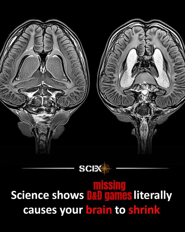 SCEX missing Science shows D&D games literally causes your brain to shrink