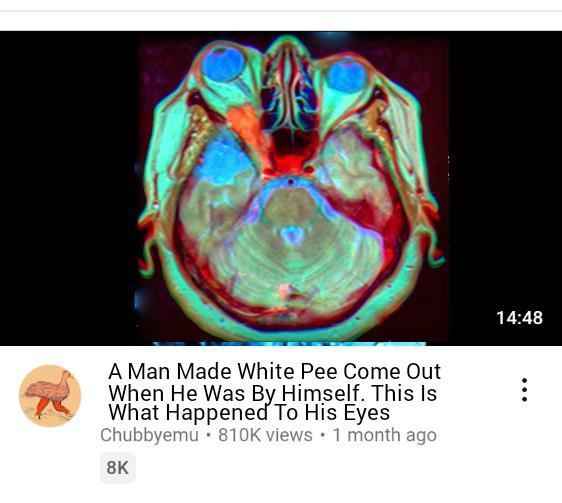 A Man Made White Pee Come Out When He Was By Himself. This Is What Happened To His Eyes Chubbyemu 810K views 1 month ago 8K 14:48