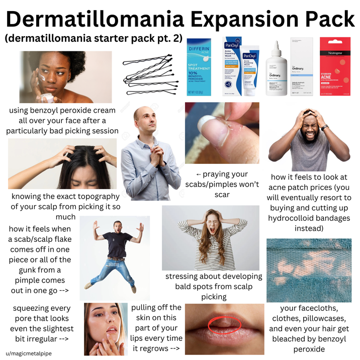 Dermatillomania Expansion Pack (dermatillomania starter pack pt. 2) DIFFERIN SPOT ACNE TREATMENT 10% BENZOYL PEROXIDE ACNE TREATMENT PanOxyl Acne Foaming Wash for Face & Body 10% BENZOYL PEROXIDE ACNE TREATMENT WASH MAXIMUM STRENGTH Clears existing acne and helps breakouts Maximum strength without a prescriptions PanOxyl Acne Foaming Wash wash for Face & Body Formulations with hoogty Ordinary. Body Care. The Ordinary. Body Care. The Clearing and helps breakouts RECOMMENDED Netw. Ter (28) Neutrogena DERMATOLOGIST RECOMMENDED BRAND Sally Acid Corps Wide Salicylic Acid 0.5% Body Serum An Exfoliating Solution Formulated for Blemish-Prone Skin STUBBORN ACNE ULTRA-THIN BLEMISH PATCHES Hytrocolloid removes impurities to help pimples look smaller and flatter after one use using benzoyl peroxide cream all over your face after a particularly bad picking session knowing the exact topography of your scalp from picking it so much how it feels when a scab/scalp flake comes off in one piece or all of the gunk from a alamy Q123RF* Q123R NET WT 1 OZ (28 g) Net wt. loz (20g) 240 mLe 81for US 24 CT PATCHES - praying your scabs/pimples won't scar how it feels to look at acne patch prices (you will eventually resort to buying and cutting up hydrocolloid bandages instead) pimple comes out in one go --> squeezing every pore that looks even the slightest bit irregular --> u/magicmetalpipe stressing about developing bald spots from scalp picking pulling off the skin on this part of your lips every time it regrows --> your facecloths, clothes, pillowcases, and even your hair get bleached by benzoyl peroxide ACTUAL SIZE