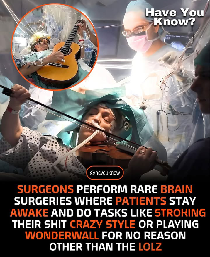 13 @haveuknow Have You Know? SURGEONS PERFORM RARE BRAIN SURGERIES WHERE PATIENTS STAY AWAKE AND DO TASKS LIKE STROKING THEIR S--- CRAZY STYLE OR PLAYING WONDERWALL FOR NO REASON OTHER THAN THE LOLZ