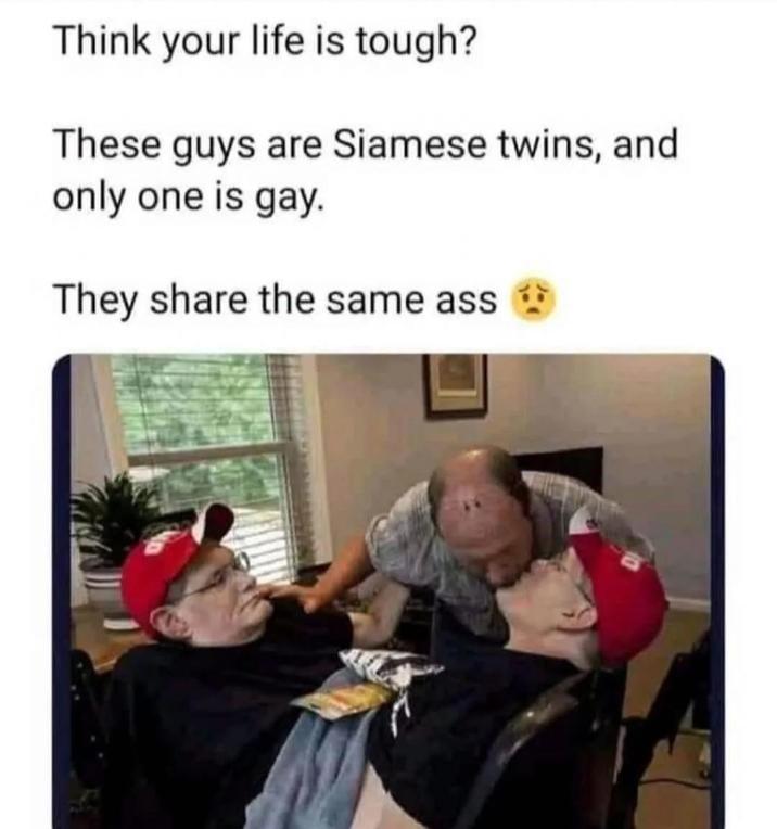 Think your life is tough? These guys are Siamese twins, and only one is gay. They share the same ass