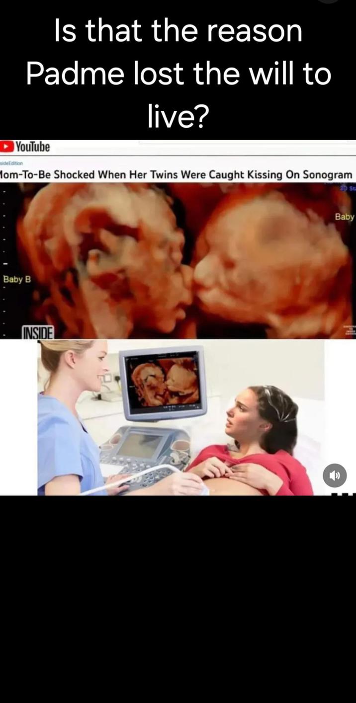 Is that the reason Padme lost the will to live? YouTube sideEdition Mom-To-Be Shocked When Her Twins Were Caught Kissing On Sonogram Baby B INSIDE 3D St Baby