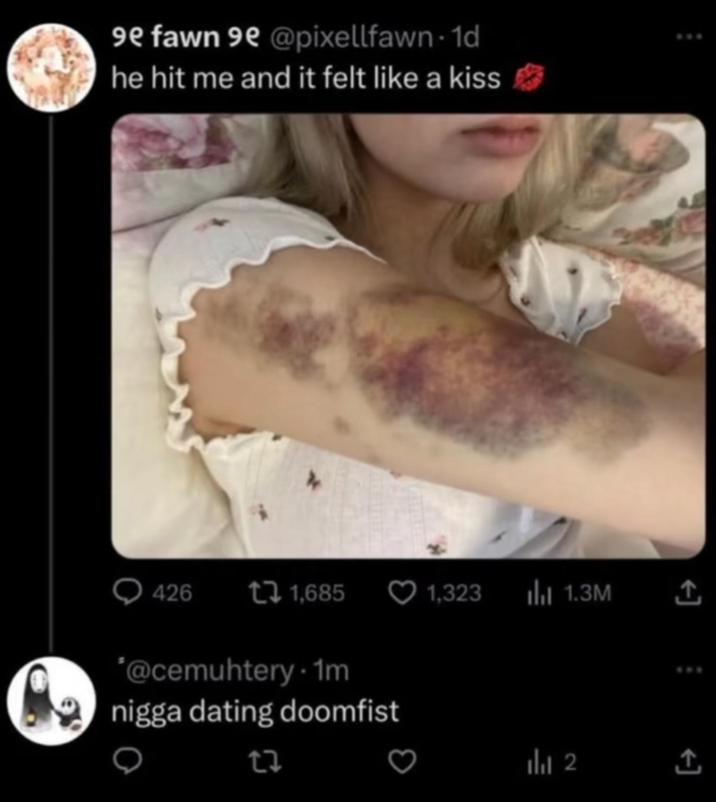 9e fawn 9e @pixellfawn-1d he hit me and it felt like a kiss 426 1,685 1,323 lil 1.3M *@cemuhtery.1m n---- dating doomfist 27 2 +]