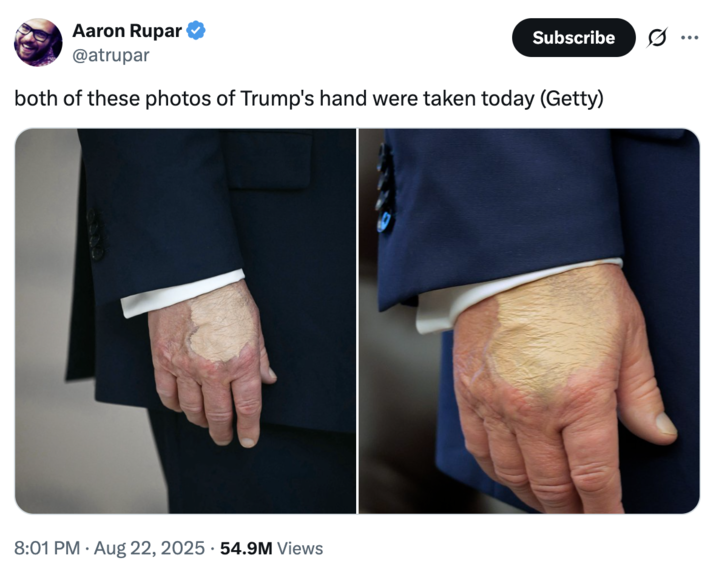 both of these photos of Trump's hand were taken today (Getty) A "tweet":https://knowyourmeme.com/memes/sites/twitter-x with both August 2025 photos of "U.S.":https://knowyourmeme.com/memes/cultures/united-states-of-america President "Donald Trump's":https://knowyourmeme.com/memes/people/donald-trump hand with what appears to be a layer of makeup foundation covering an injury.