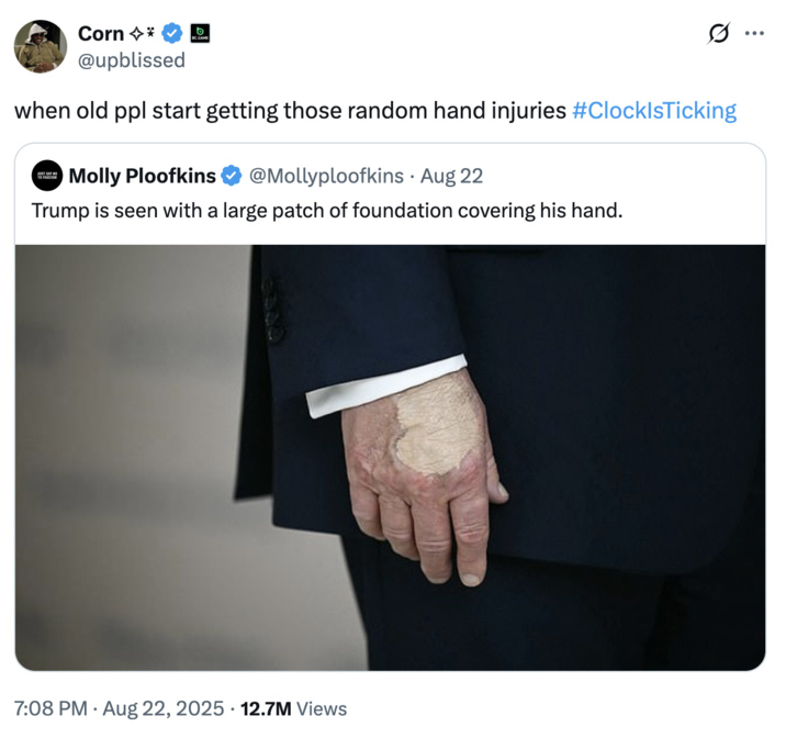 when old ppl start getting those random hand injuries #ClockIsTicking A "quote-tweet":https://knowyourmeme.com/memes/quote-retweets-qrts joking about "Donald Trump":https://knowyourmeme.com/memes/people/donald-trump and the makeup/bruising on his hand, which caused speculation about his impending death.