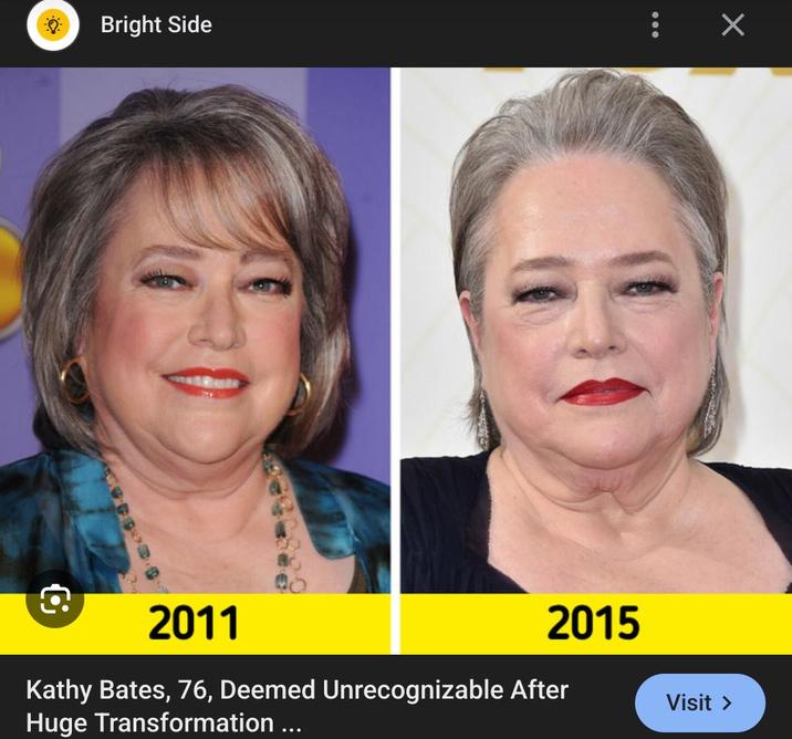 Bright Side 2011 Х 2015 Kathy Bates, 76, Deemed Unrecognizable After Huge Transformation ... Visit >
