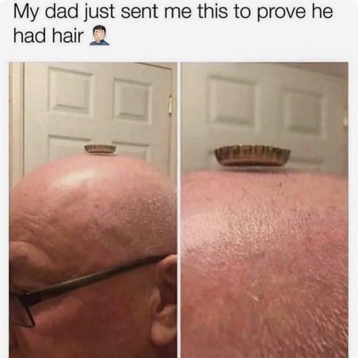My dad just sent me this to prove he had hair