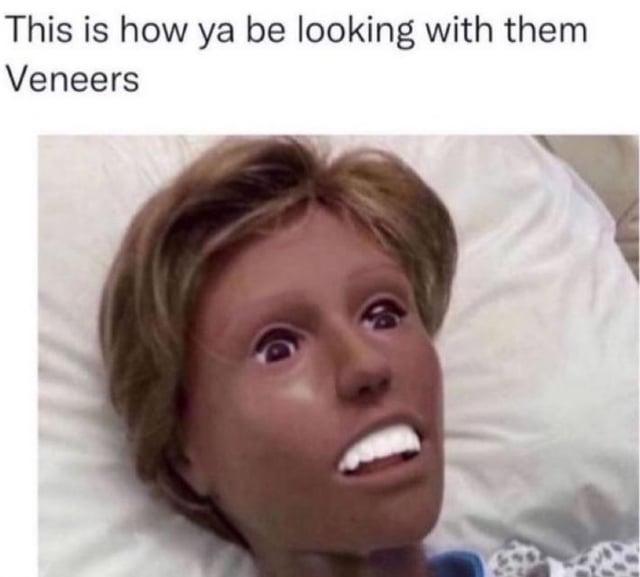 This is how ya be looking with them Veneers