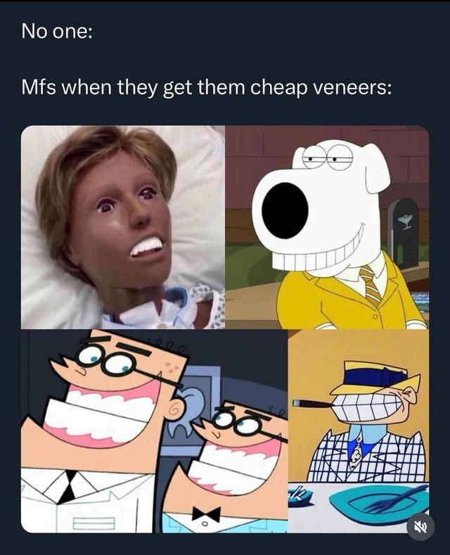 No one: Mfs when they get them cheap veneers: 1000